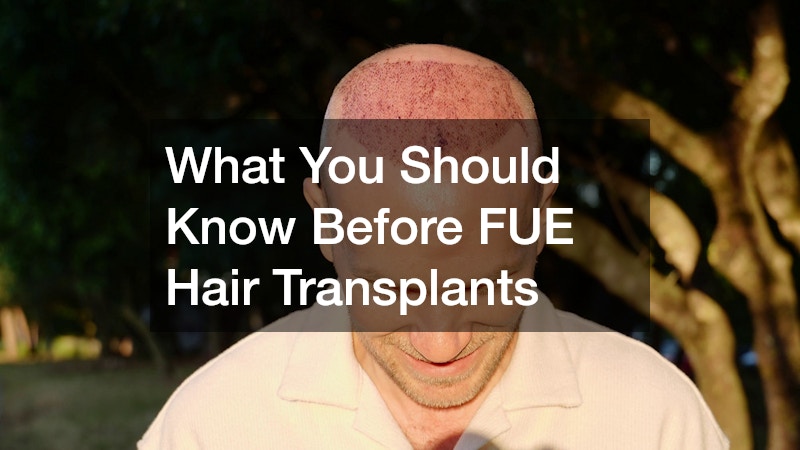 What You Should Know Before FUE Hair Transplants